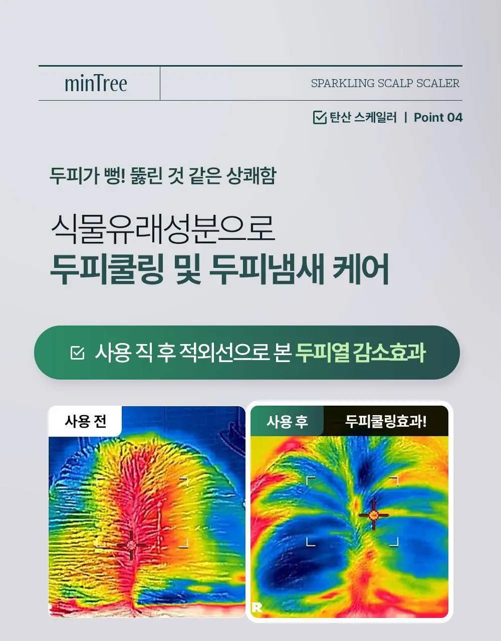 [단독기획] 민트리 트리트먼트 200ml 기획 (+두피스케일러 15g 증정) 상세페이지 57